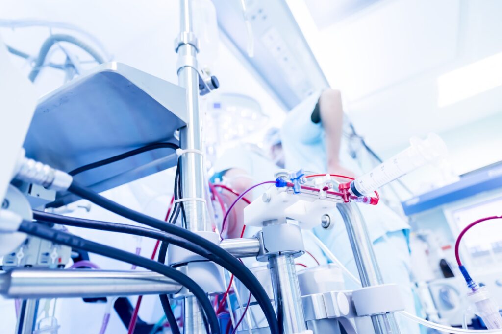 Close-up of ECMO circuit and perfusion equipment in active use—supporting high-acuity cardiac and pulmonary support.