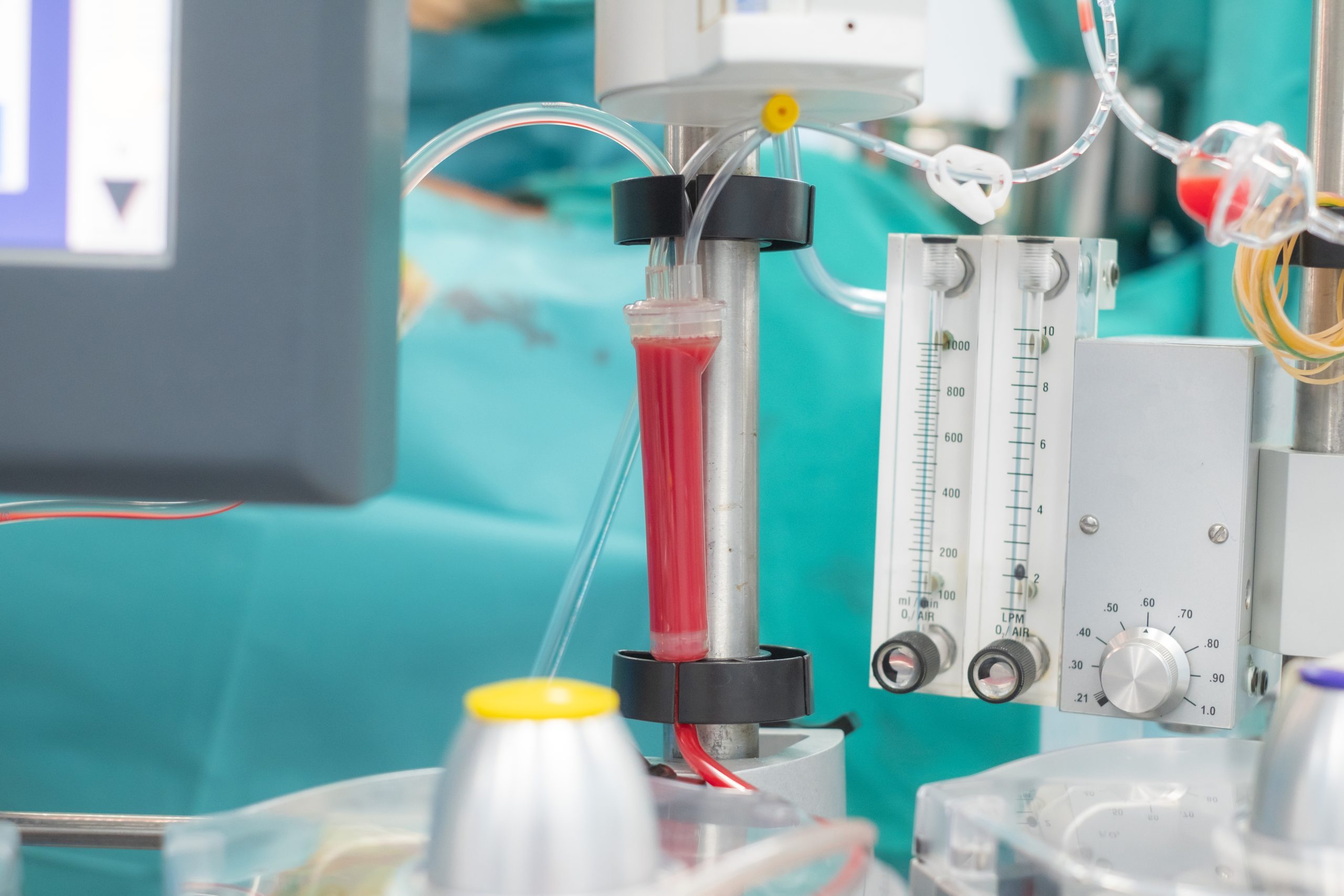 Oxygenation and flow monitor in active perfusion setup—visualizing real-time blood management during surgery.
